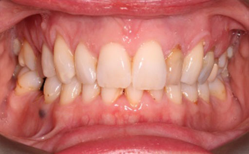 BassettDental - Before